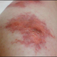 Image for article titled Bonus: Nine More Totally Gross Stories